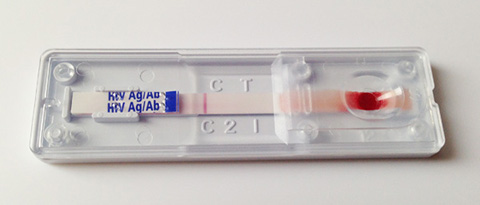 第四步，查看检测结果